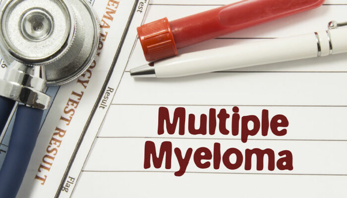 7 Warning Signs and Symptoms of Multiple Myeloma