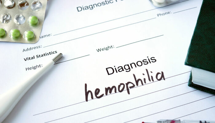 8 signs and symptoms of hemophilia