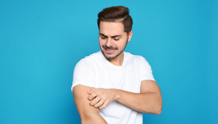 9 common warning signs of prurigo nodularis