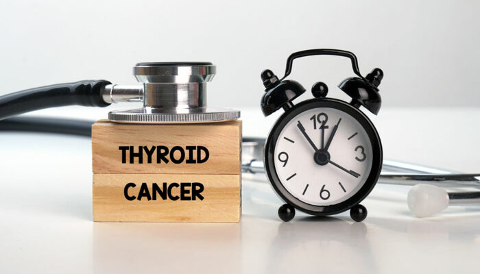 Hidden Signs of Thyroid Cancer