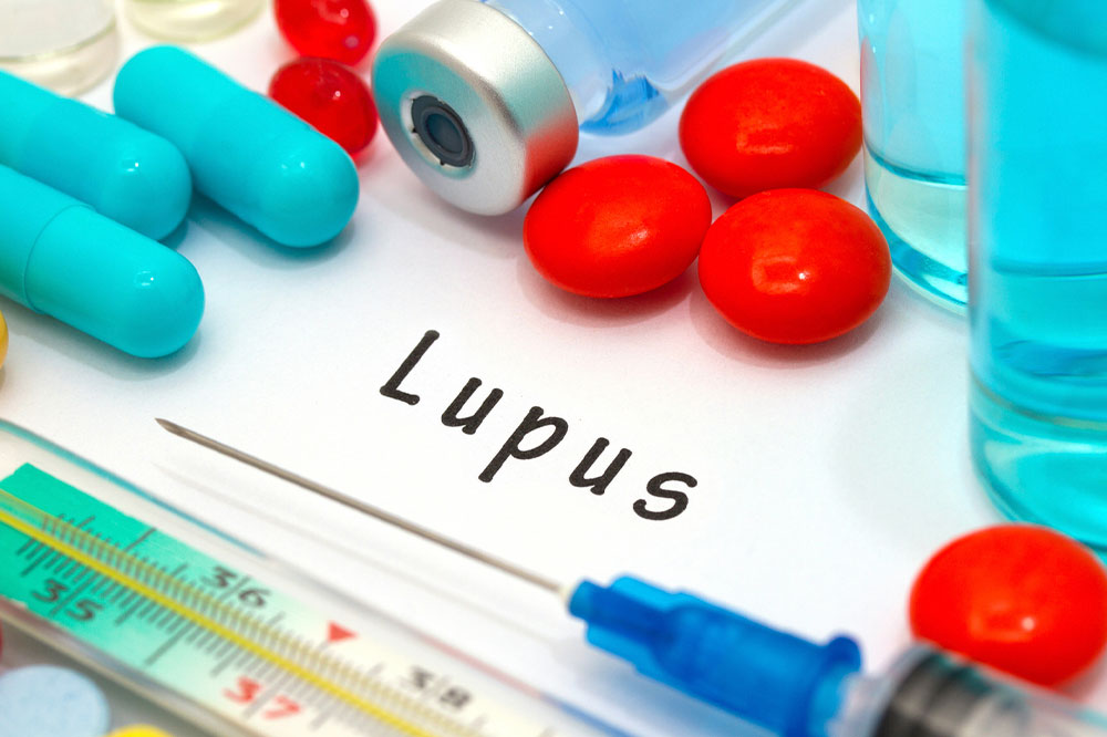 Lupus &#8211; Symptoms, Risk Factors, and Diagnosis