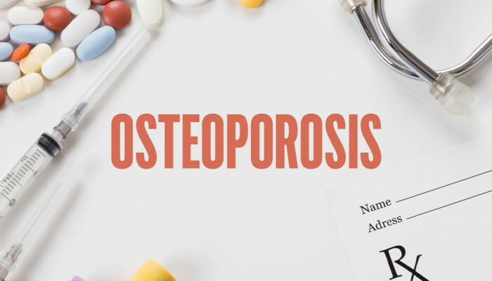 Natural Factors and Health Conditions that Increase the Risk of Osteoporosis