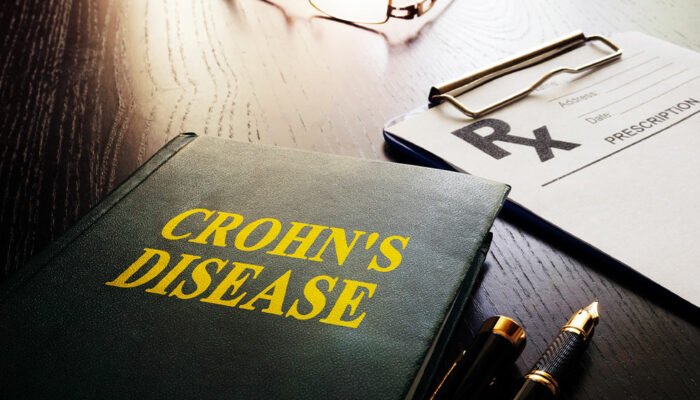 Warning signs of Crohn&#8217;s disease